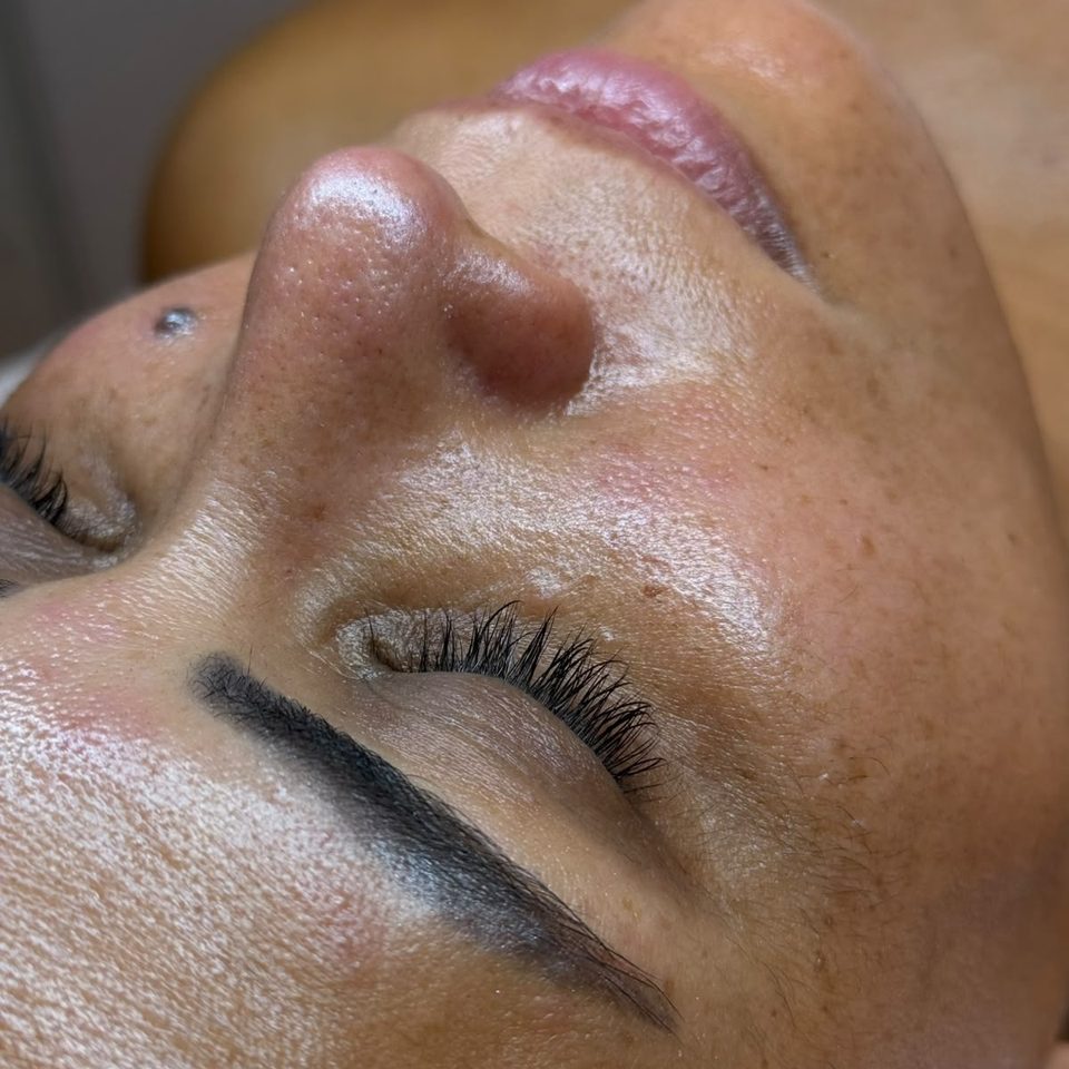Higiene facial básica